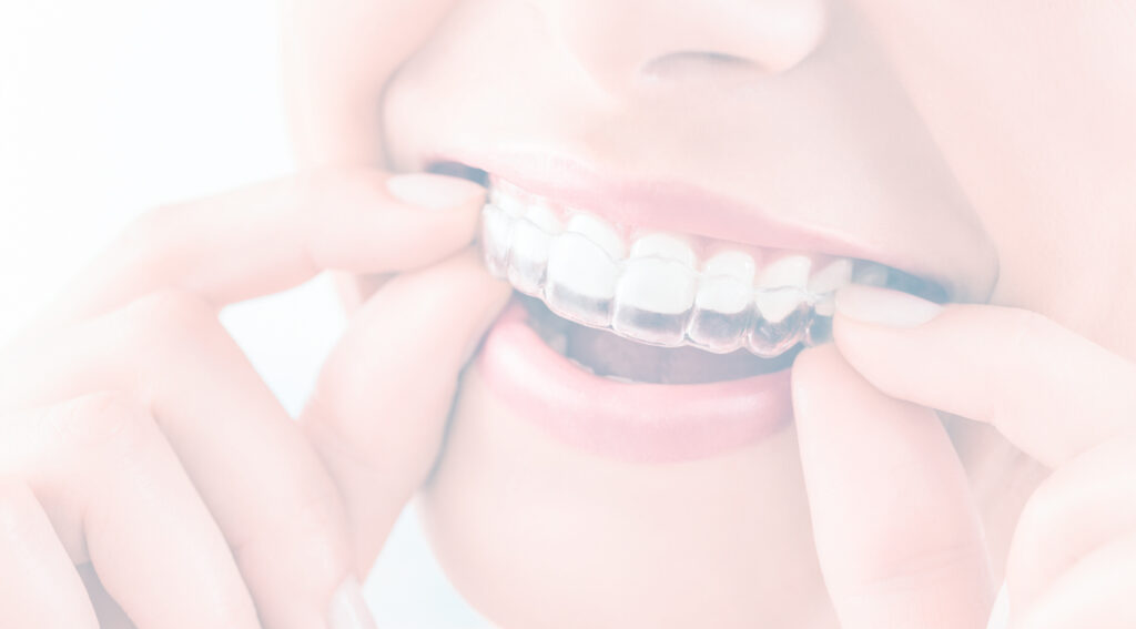 Close Up Shot Of Woman Putting In Clear Aligner
