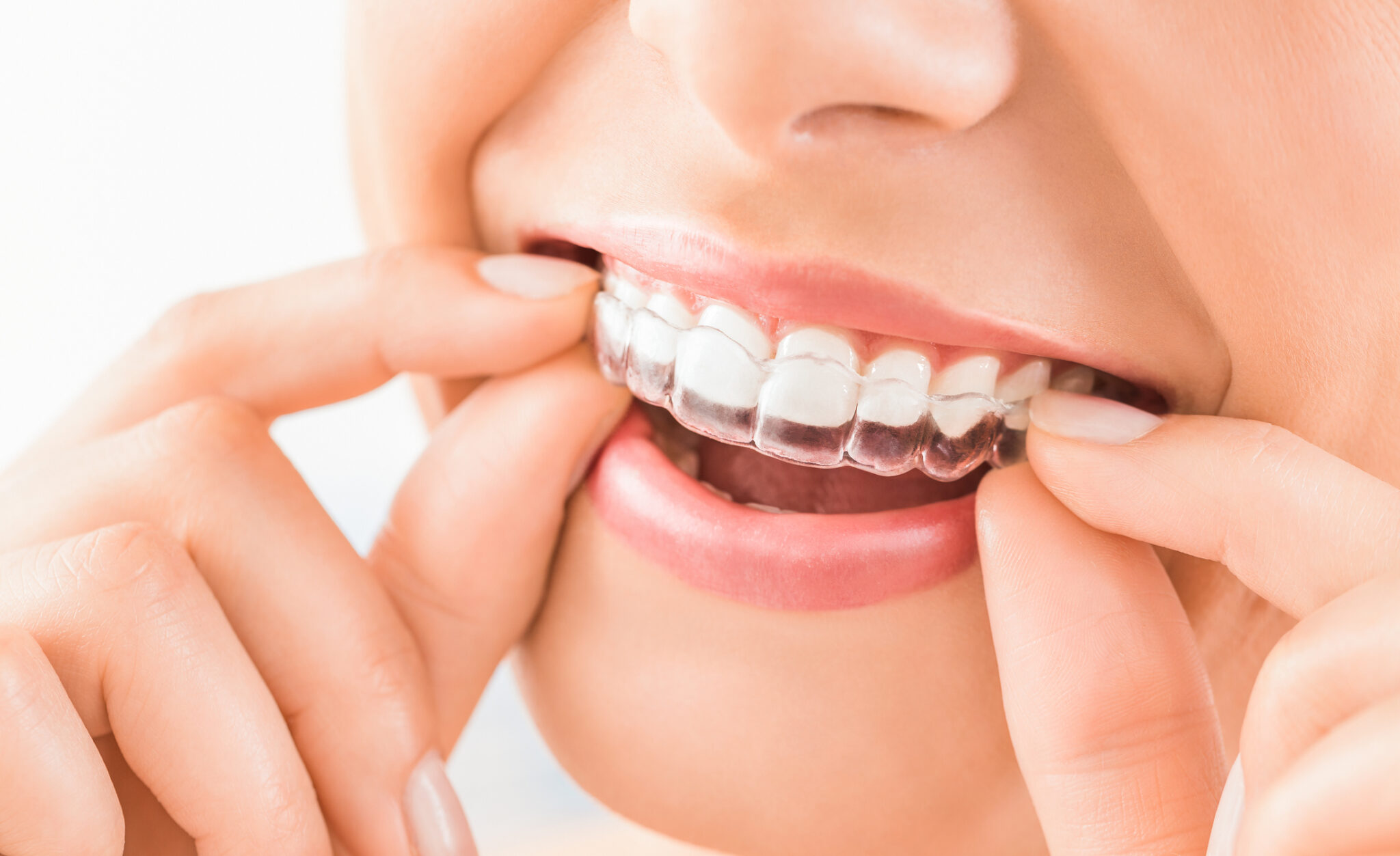Beautiful Smile And White Teeth Of A Young Woman.
