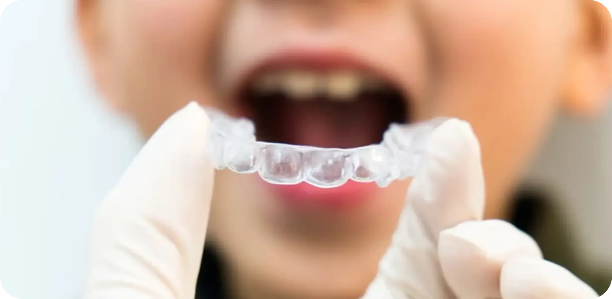 Boy getting a retainer